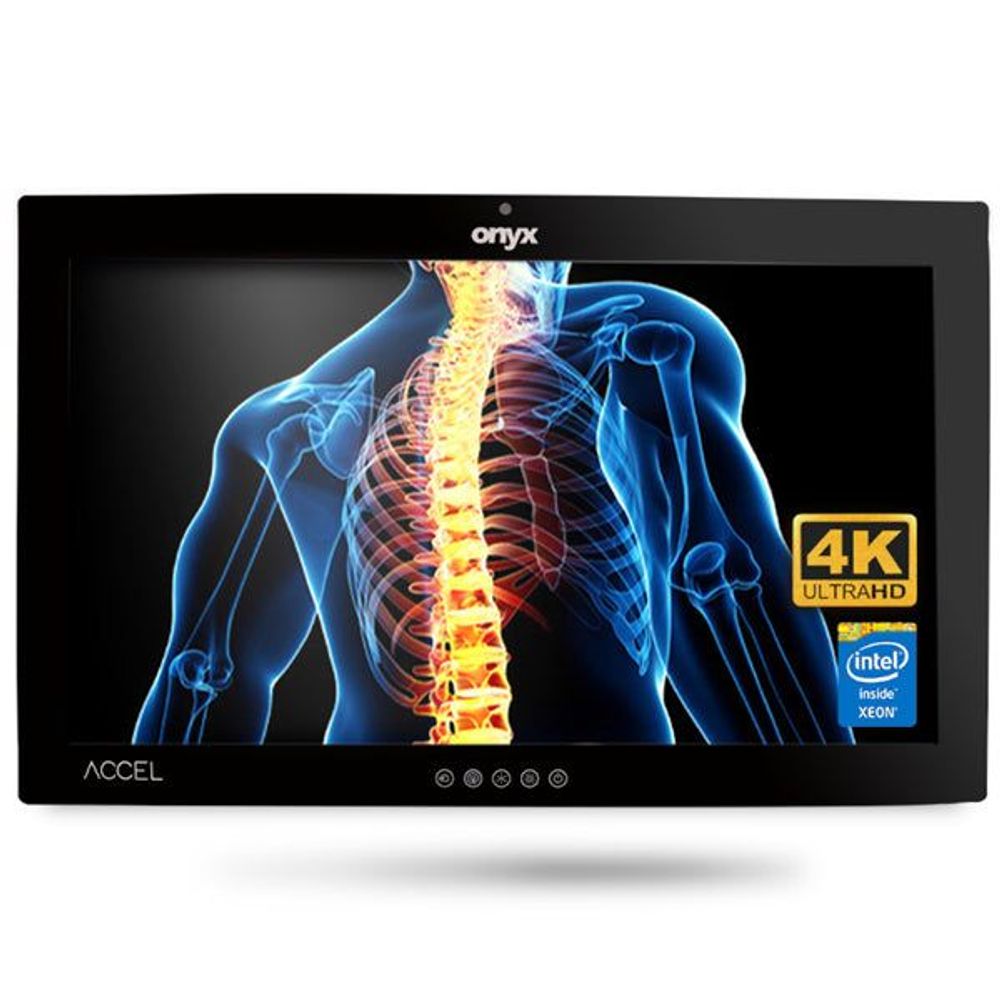 ACCEL-A2701-P2-A1-00 - Onyx ACCEL-A2701 i7 27