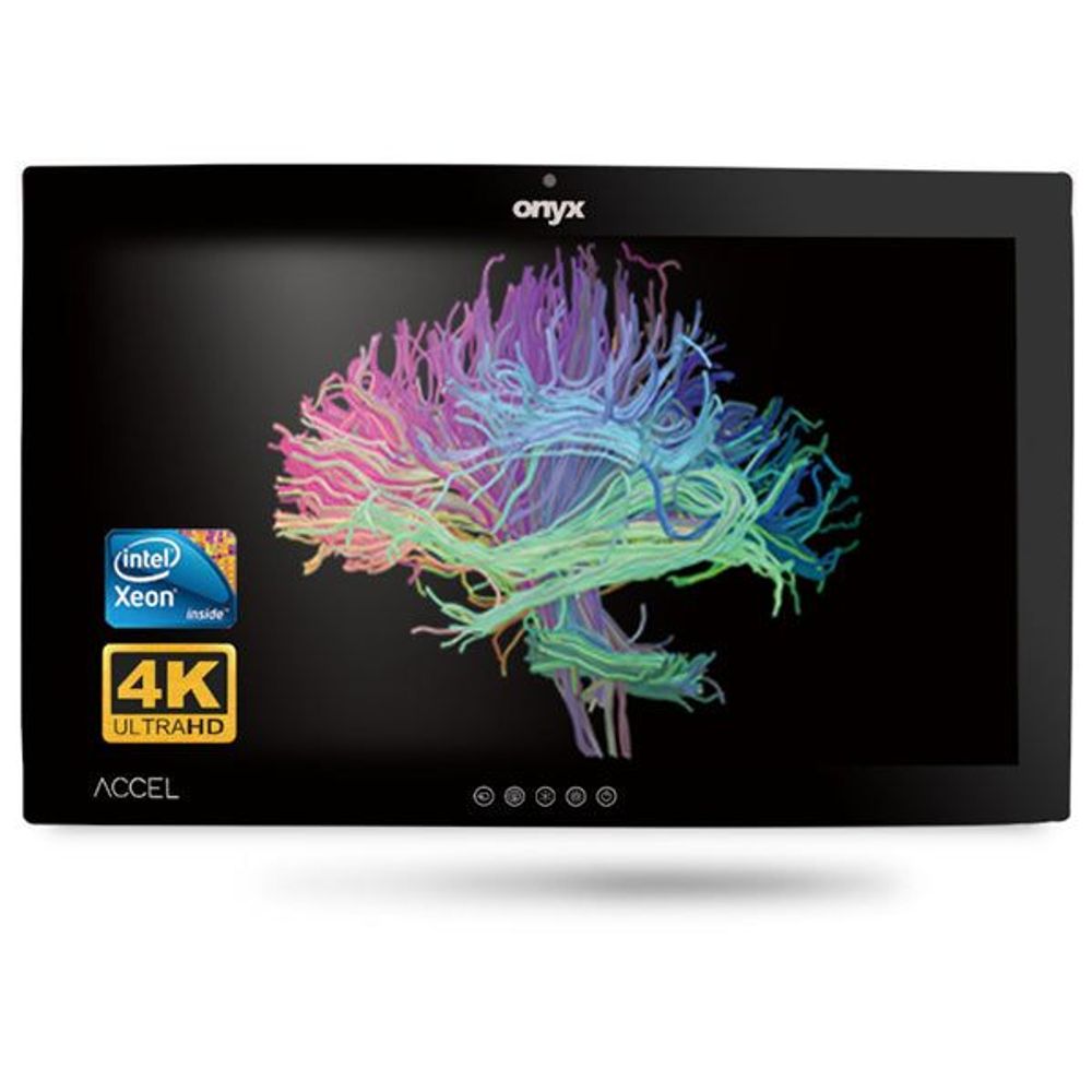 ACCEL-A3201-P2-A1-00 - Onyx ACCEL-A3201 i7 32
