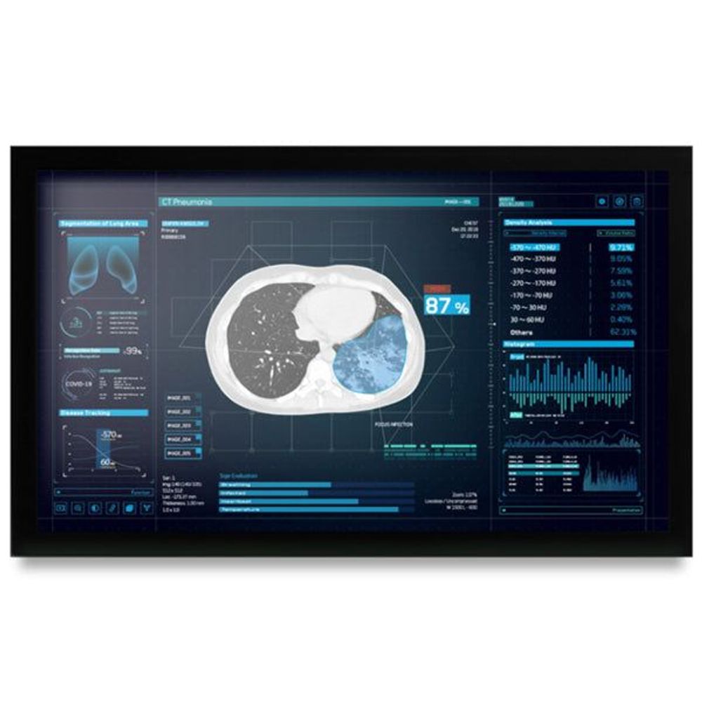 MEDDP-627HNN-A1-1010 - Onyx MEDDP-627HNN 27" Medical Display