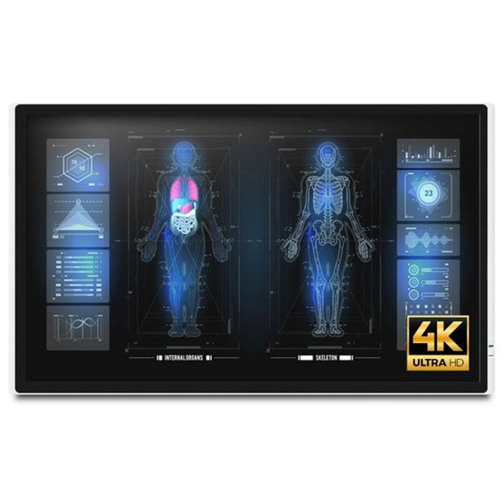 MEDDP-632-P1-A1-0010 - Onyx MEDDP-632-P1 32" 4K Medical Touch Display
